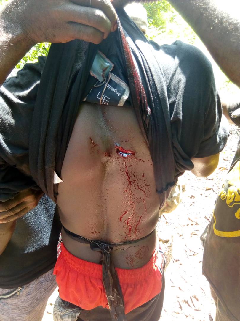 Mafac Rescues Dying Mamfe Gun Shot Victim