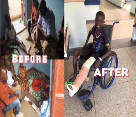 uganda-boy MAFAC INTERVENES TO SAVE A UGANDAN BOY’S LEG